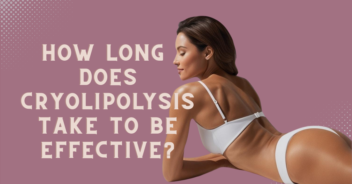 How Long Does Cryolipolysis Take to Be Effective?