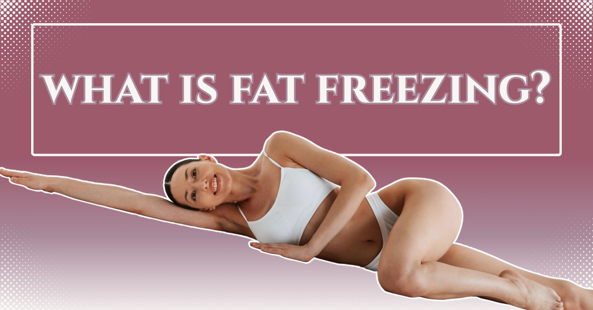 What Is Fat Freezing: Practical Explanation & Benefits