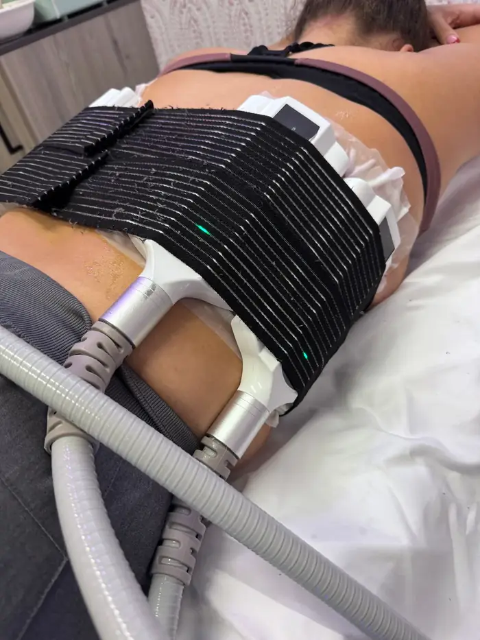 Inside a CryoLipo + EMS session at our Orlando studio